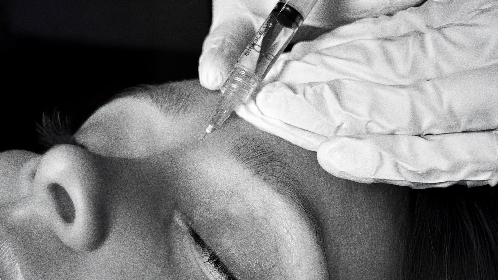 Botox & What’s Happening Beneath the Skin